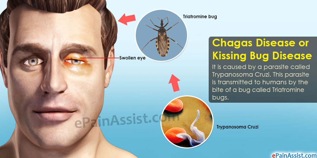 doen-a-de-chagas-causada-por-prot-zoarios-e-e-edgar-barbosa